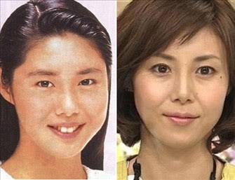 業界人が目撃して「笑えないほど変貌した」女性芸能人3名とは?