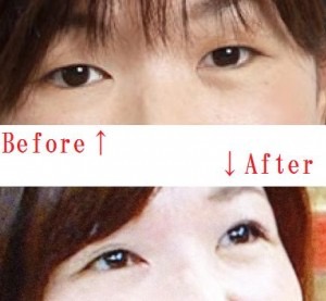 業界人が目撃して「笑えないほど変貌した」女性芸能人3名とは?