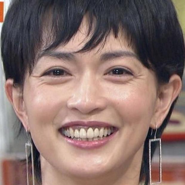 業界人が目撃して「笑えないほど変貌した」女性芸能人3名とは?