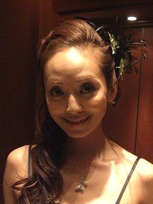 業界人が目撃して「笑えないほど変貌した」女性芸能人3名とは?