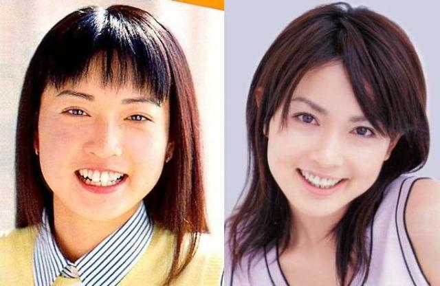 業界人が目撃して「笑えないほど変貌した」女性芸能人3名とは?