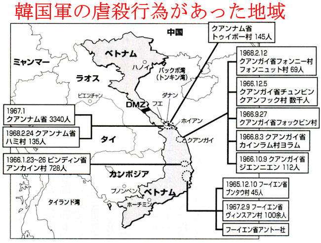キム・ヨナが日本の芸能界デビューを狙って大整形手術