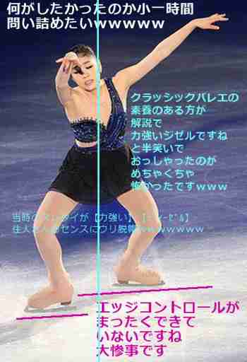 キム・ヨナが日本の芸能界デビューを狙って大整形手術
