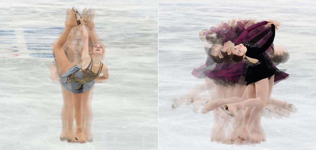 キム・ヨナが日本の芸能界デビューを狙って大整形手術