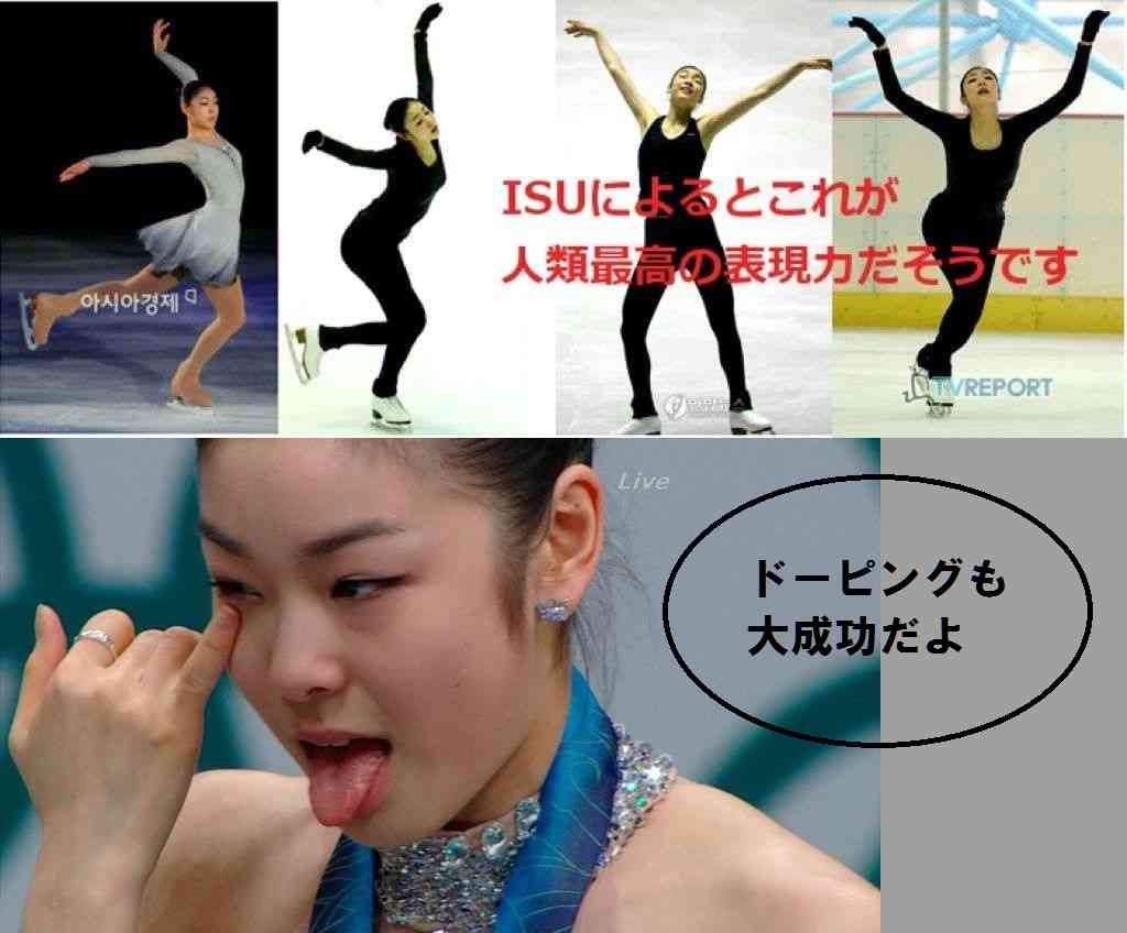 キム・ヨナが日本の芸能界デビューを狙って大整形手術