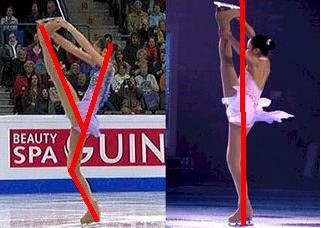 キム・ヨナが日本の芸能界デビューを狙って大整形手術