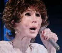 キム・ヨナが日本の芸能界デビューを狙って大整形手術