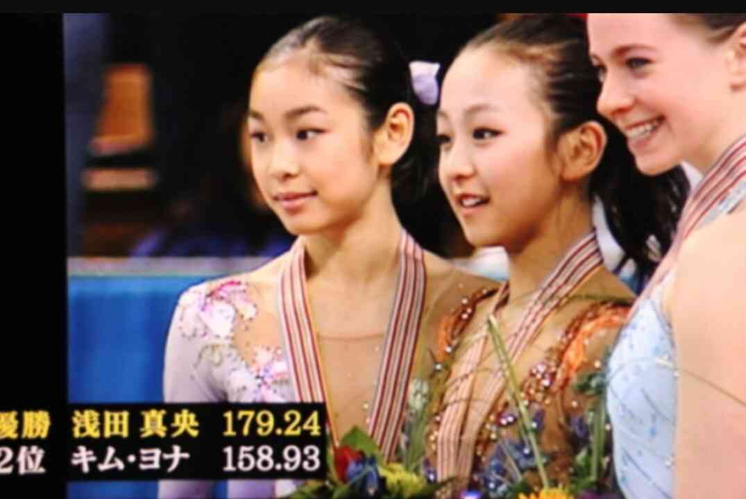 キム・ヨナが日本の芸能界デビューを狙って大整形手術