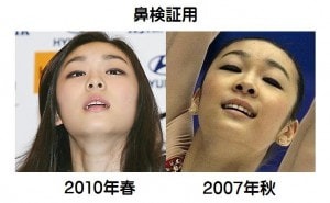 キム・ヨナが日本の芸能界デビューを狙って大整形手術