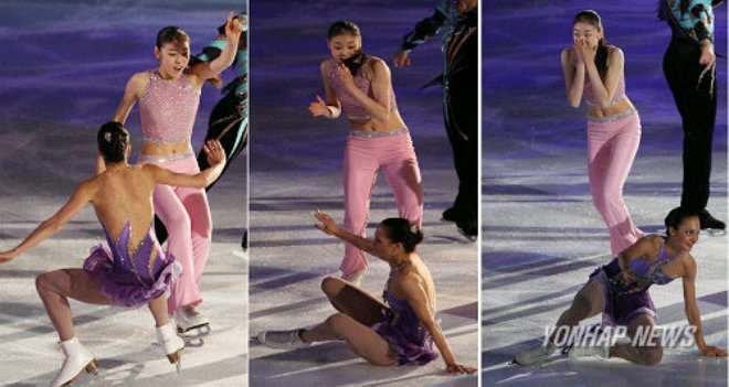 キム・ヨナが日本の芸能界デビューを狙って大整形手術