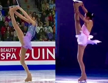 キム・ヨナが日本の芸能界デビューを狙って大整形手術