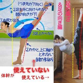 キム・ヨナが日本の芸能界デビューを狙って大整形手術