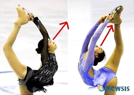 キム・ヨナが日本の芸能界デビューを狙って大整形手術