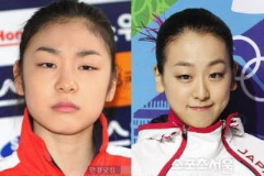 キム・ヨナが日本の芸能界デビューを狙って大整形手術