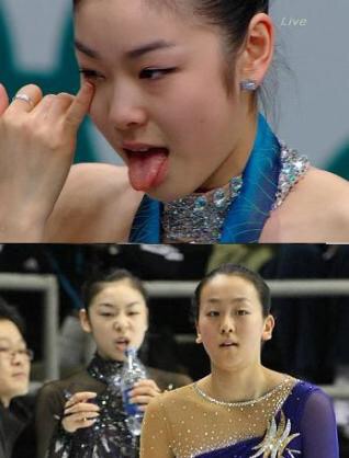 キム・ヨナが日本の芸能界デビューを狙って大整形手術