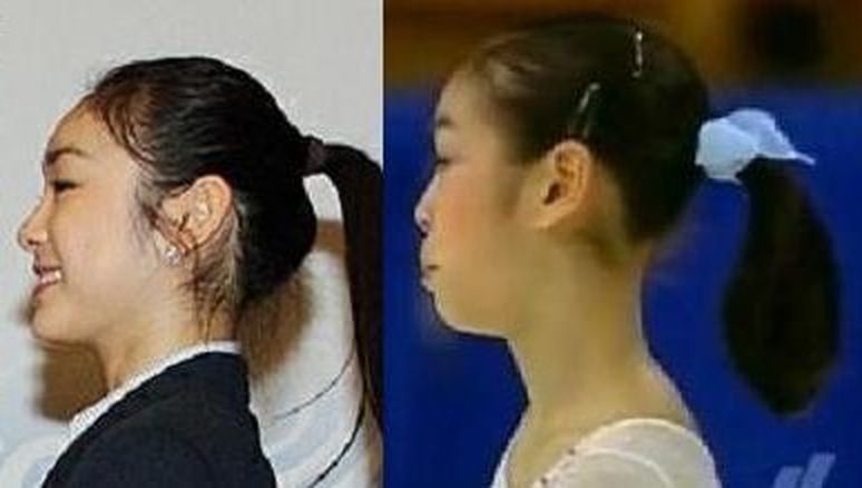 キム・ヨナが日本の芸能界デビューを狙って大整形手術