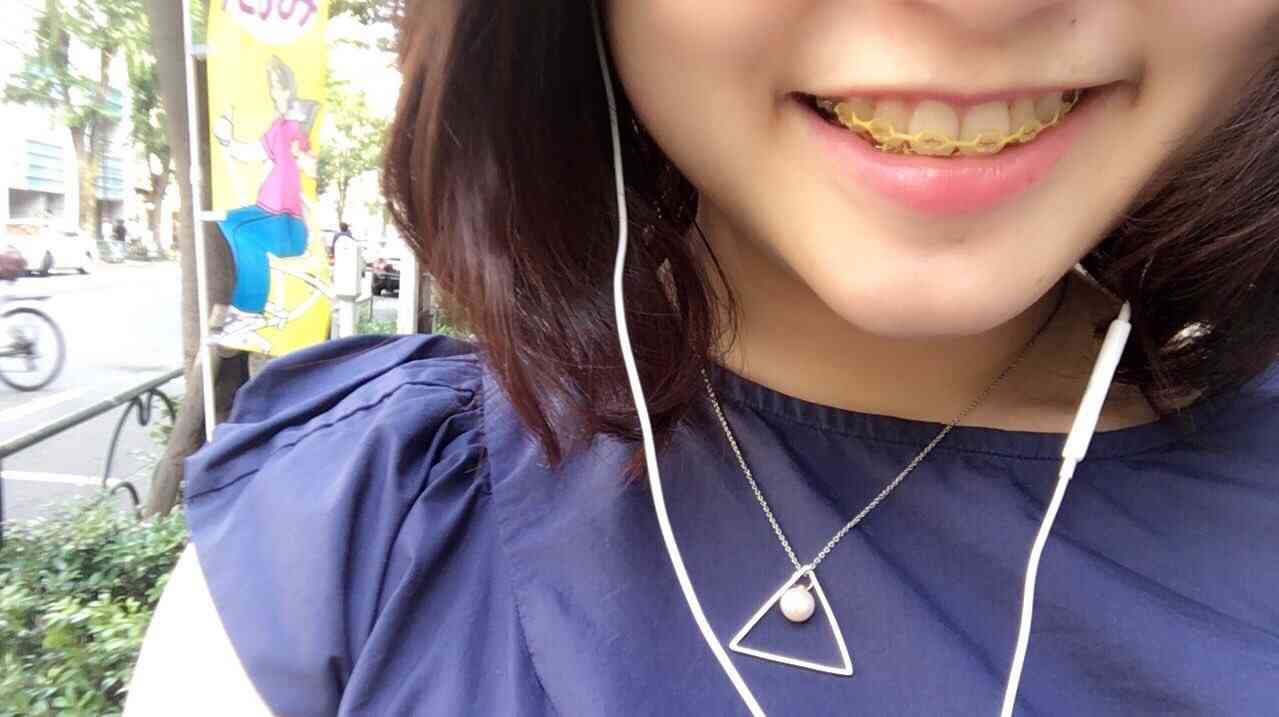 30代からの歯科矯正。
