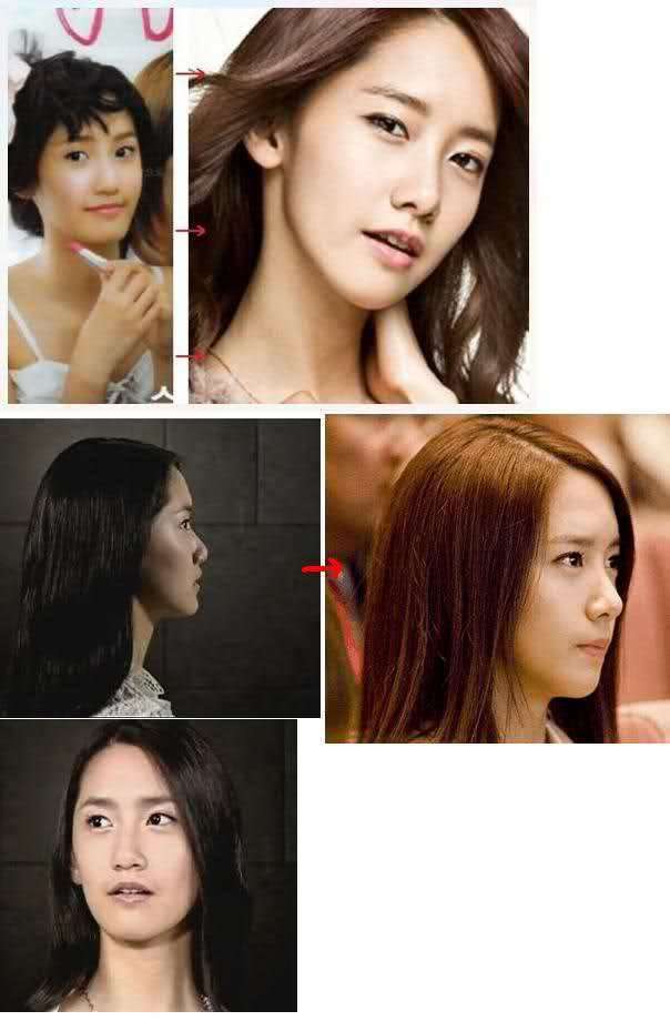 在日特権は本当にありますか？