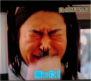 【閲覧注意】痛~い画像を貼るトピ
