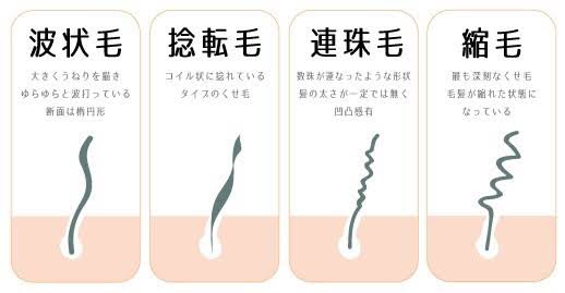 縮毛(チリチリ)の人いますか?