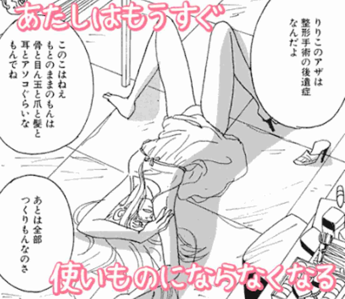 どうして美容整形すると劣化するんですか？
