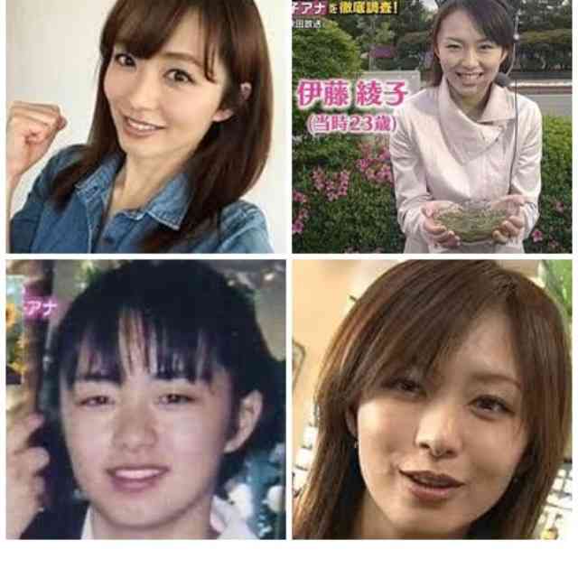 どうして美容整形すると劣化するんですか？