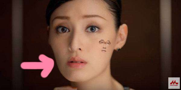 どうして美容整形すると劣化するんですか？