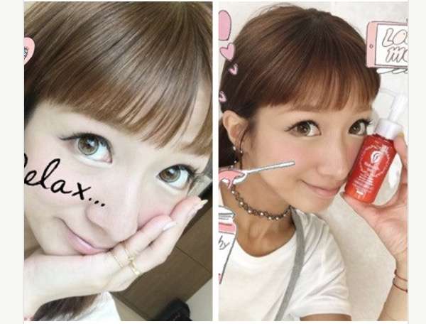 どうして美容整形すると劣化するんですか？