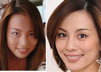 黒目が小さい芸能人