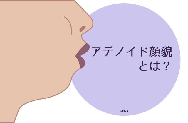 横顔がブスな人