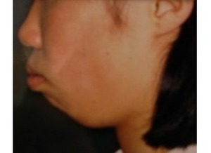 横顔がブスな人