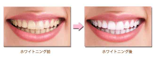 やめられない物事をやめたら年間いくら貯まりますか?