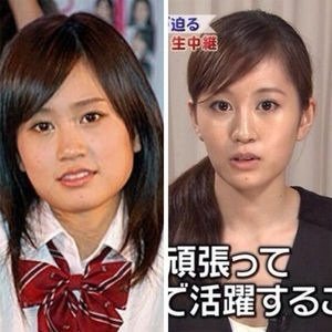 広瀬すず、あの