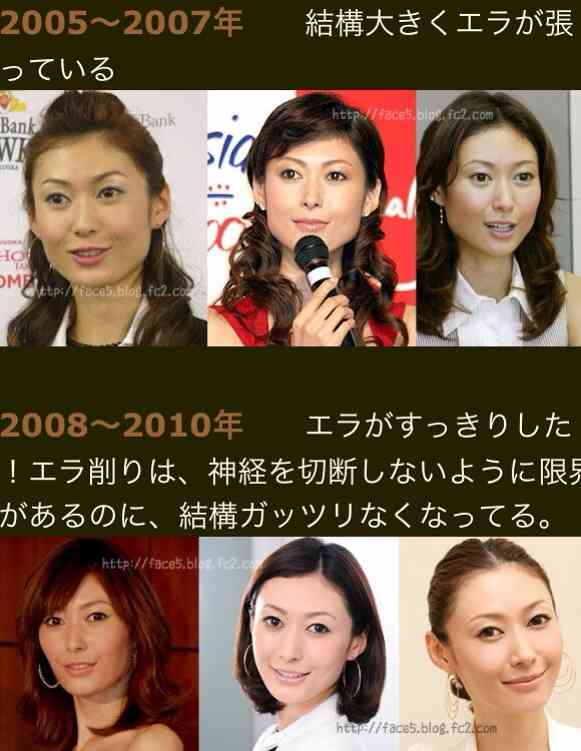 広瀬すず、あの