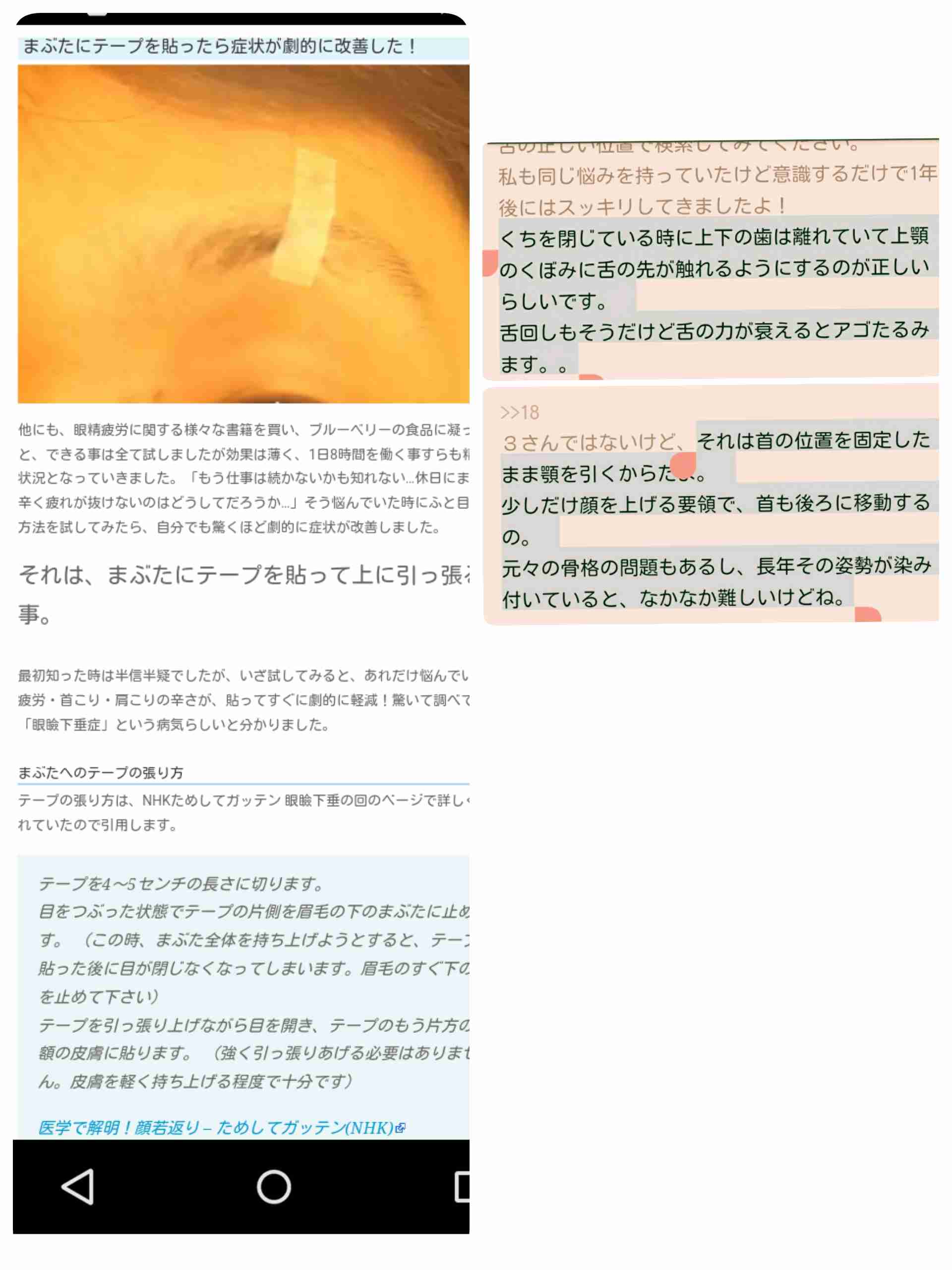ストレートネックの人