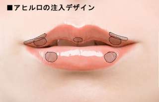 アヒル口だと思う芸能人を挙げていくトピ