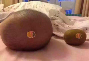 【毒親】閲覧注意！子供の悲劇的な写真をSNSにアップする親が海外で話題に。