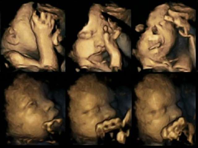 【毒親】閲覧注意！子供の悲劇的な写真をSNSにアップする親が海外で話題に。