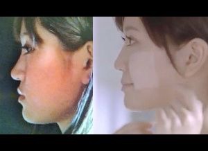 鼻低いあるある