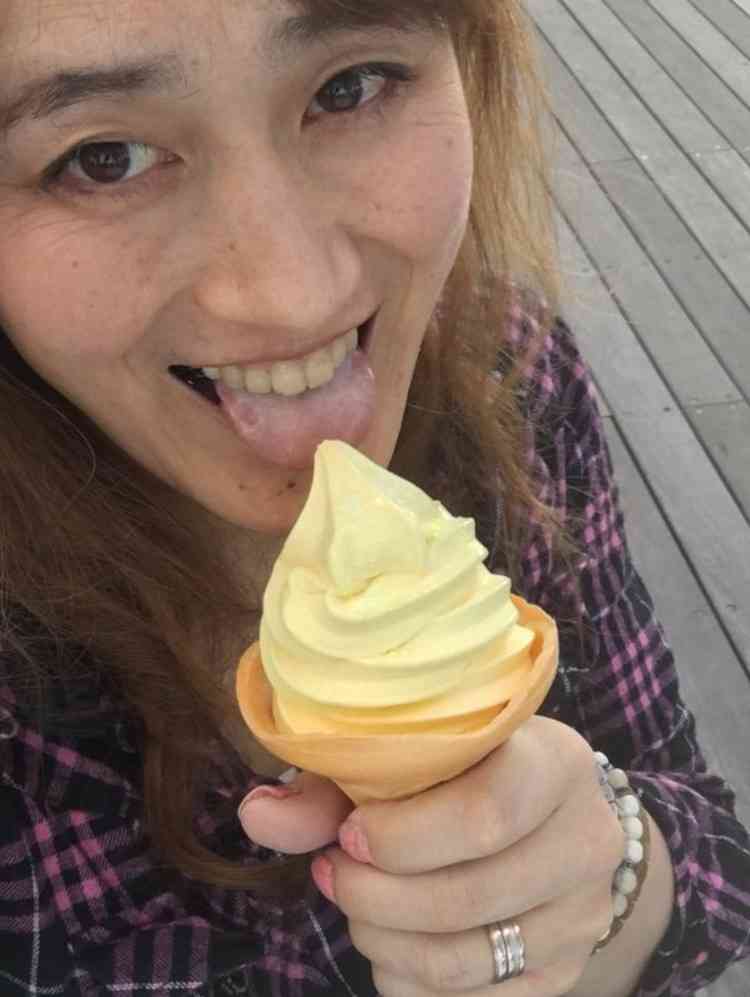 法令線の具合