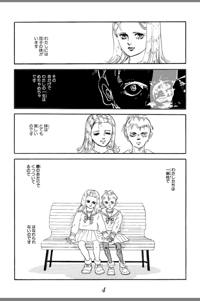 頭部が一つにつながった双子の男の子…NYで分離手術