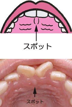 お口の悩みやトラブルありませんか?