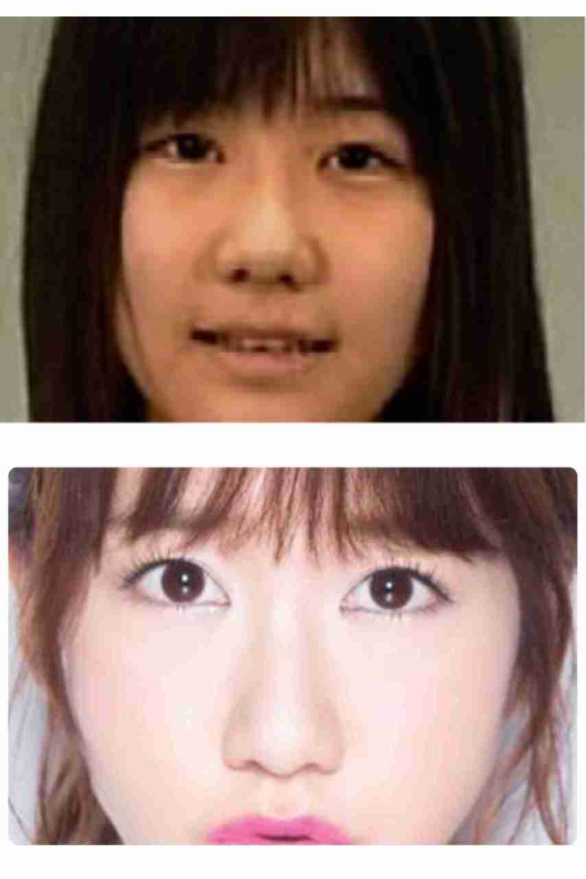 AKB48柏木由紀の鼻がますます大きくなっていると話題に