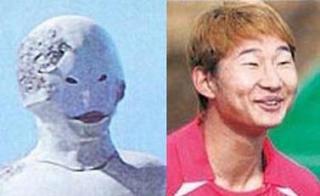 頬骨が高くて悩んでる人