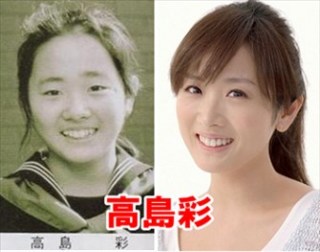 頬骨が高くて悩んでる人