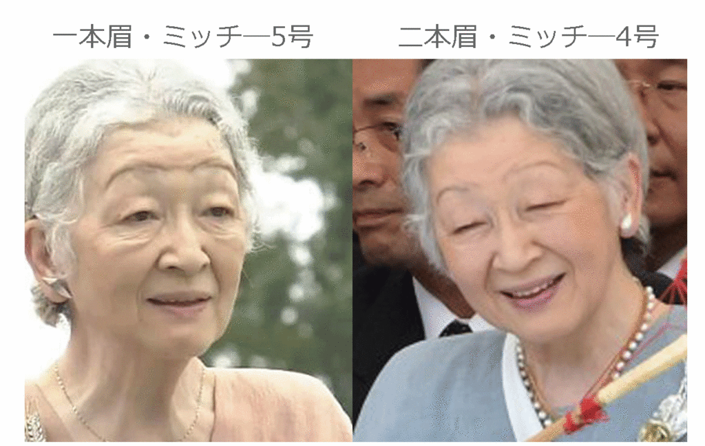 【皇室】皇后さまが急性気管支炎