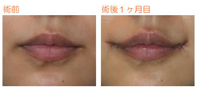 板野友美、高級ブランド品をインスタに次々アップするセレブぶりが話題に！
