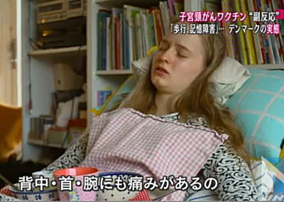 ワクチン非接種者も症状＝体痛みなど、子宮頸がん調査－厚労省研究班