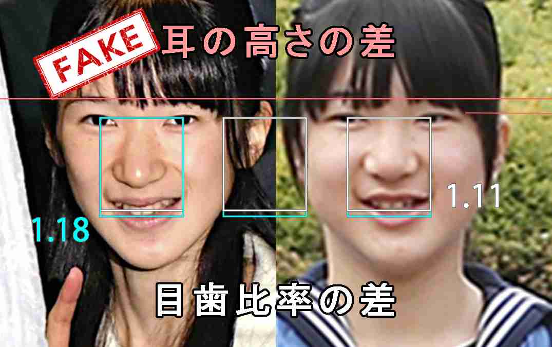 炭水化物抜きダイエット実践の愛子さま「摂食障害」の指摘も