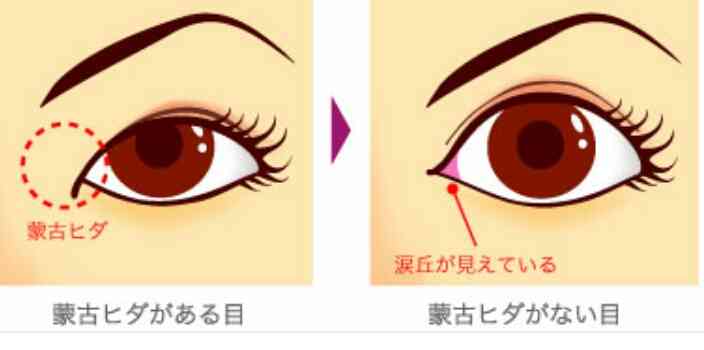 平行二重の目ってそんなにいいですか?